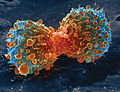 Kræftceller i deling. Foto: NIH, USA