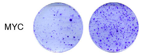 Celler der mangler Prdm11 udvikler sig lettere til kræftceller, da kræftgener som MYC får frit spil. Det kan ses af forskernes forsøg, som viser at der kommer flere kræftcellekolonier (lilla pletter i dyrkningsskålene), når cellerne mangler PRDM11. Foto: Cathrine Fog-Tonnesen.