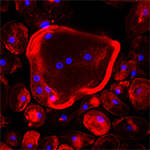 Microscope image of bone-destroying osteoclast cells generated by exposure to lysyl oxidase (red= cell body, blue= DNA)