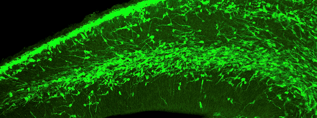 Developing mouse brain, green cells are migrating immature neurons