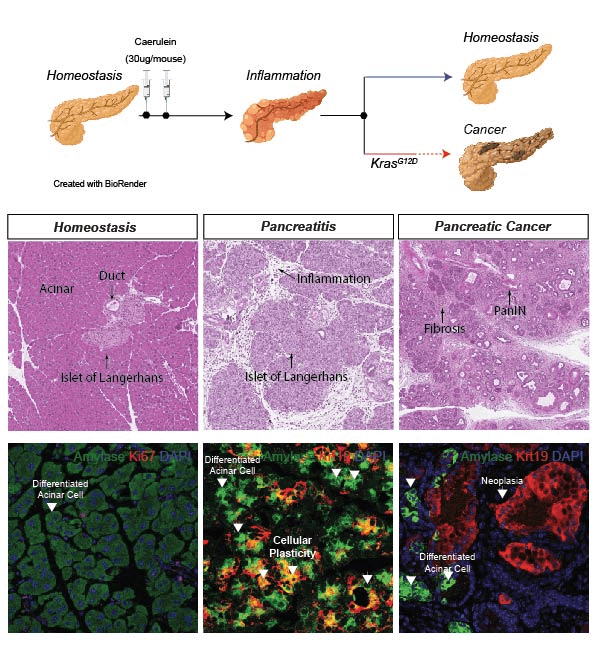 We have established a colony of pancreatic cancer mouse model (KC and KPC) that phenocopies many of the clinical manifestations of human PDAC. Tumors present with a prominent fibrous inflammatory reaction and spontaneously progress into metastatic PDAC. To study cancer initiation, we use the K-Ras G12D alleles (KC), which develops precursor lesions that evolve into invasive carcinoma after a long latency period. To study the interaction of tissue injury and cancer initiation we trigger pancreatic damage and tissue inflammation by the supraphysiological administration of caerulein (cholecystokinin analogue) in mice. It generates an acute pancreatitis that resolves within two weeks. However, the presence of an activating mutation in K-Ras prevents the resolution of tissue injury and results in the emergence of pancreatic intraductal neoplasia (PanINs) considered the precursor lesions of PDAC