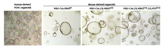 We are using a model of PDAC initiation using an inducible K-RAS activating mutation (K-RASG12V) in human embryonic stem cells. Top figure shows a schematic representation of the model depicting the steps to generate PDAC lesions from human embryonic stem cells. Botton figure shown pancreas progenitors derived from HUES8 grown in 3D. Molecular evidence showing the tight regulation of KrasG12D expression with doxycycline.