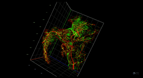 Ductal tree and the Islet of Langerhans in the pancreas (mouse). Light sheet microscopy. Photo credit: Juan Camacho and Jonathan Baldan