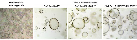 We are using a model of PDAC initiation using an inducible K-RAS activating mutation (K-RASG12V) in human embryonic stem cells. Top figure shows a schematic representation of the model depicting the steps to generate PDAC lesions from human embryonic stem cells. Botton figure shown pancreas progenitors derived from HUES8 grown in 3D. Molecular evidence showing the tight regulation of KrasG12D expression with doxycycline.