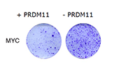 cancer cell colonies (purple spots when cultured cells lack PRDM11).